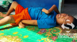 Zaelani alias (Ekok) penyandang disabilitas asal Cisolok Sukabumi. l Dok. sukabumiheadlines.com
