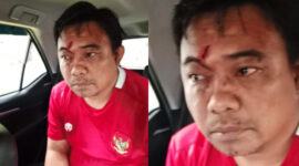 Wajah Haris Pratama babak belur. l Istimewa