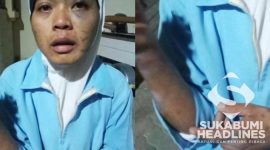Sumiati mengalami penyiksaan oleh majikan. l Istimewa