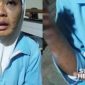 Sumiati mengalami penyiksaan oleh majikan. l Istimewa