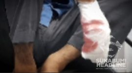 Jari MA nyaris putus disabet senjata tajam di Cicurug, Kabupaten Sukabumi. l Istimewa