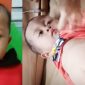 Alvian Gumilang menderita kantong bocor. l Istimewa