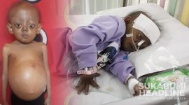 Indy Apriyanto Putri menderita tumor ganas dan komplikasi. l Istimewa