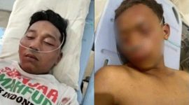 Relawan Ganjar-Mahfud korban pengeroyokan oknum TNI. l Istimewa
