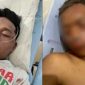 Relawan Ganjar-Mahfud korban pengeroyokan oknum TNI. l Istimewa