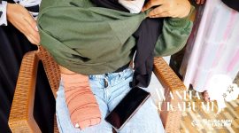 Juita, gadis Bojonggenteng, Sukabumi mengalami kecelakaan kerja yang membuat tangannya putus. l Anry Wijaya