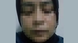 ES, Wanita Sukabumi, berangkat ilegal dan dianiaya majikan. - Istimewa