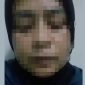 ES, Wanita Sukabumi, berangkat ilegal dan dianiaya majikan. - Istimewa