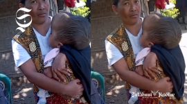 Mekanik Indonesia peduli Alya Sidqia Suci, balita NTB derita Hidrosefalus - Komunitas Mekanik Indonesia