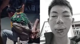 Kisah Geri Selamat, pelajar Sukabumi dianiaya warga tanpa alasan, keluarga tuntut keadilan - Ist