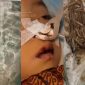 Tubuh Raya, bocah Sukabumi dipenuhi cacing - Rumah Teduh