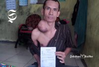 Ujang Saepulloh, warga Parakasalak Sukabumi belasan tahun derita tumor - Anry Wijaya