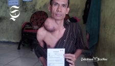 Ujang Saepulloh, warga Parakasalak Sukabumi belasan tahun derita tumor - Anry Wijaya
