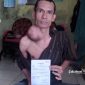 Ujang Saepulloh, warga Parakasalak Sukabumi belasan tahun derita tumor - Anry Wijaya