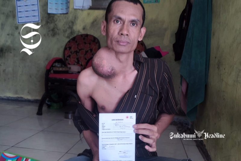 Ujang Saepulloh, warga Parakasalak Sukabumi belasan tahun derita tumor - Anry Wijaya