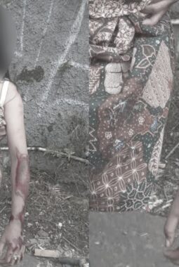 Bocah perempuan jadi korban jambret HP di Sukabumi terseret hingga 200 meter, pelaku mahasiswa