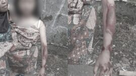 AH, bocah perempuan jadi korban jambret HP di Sukabumi terseret hingga 200 meter - Ist