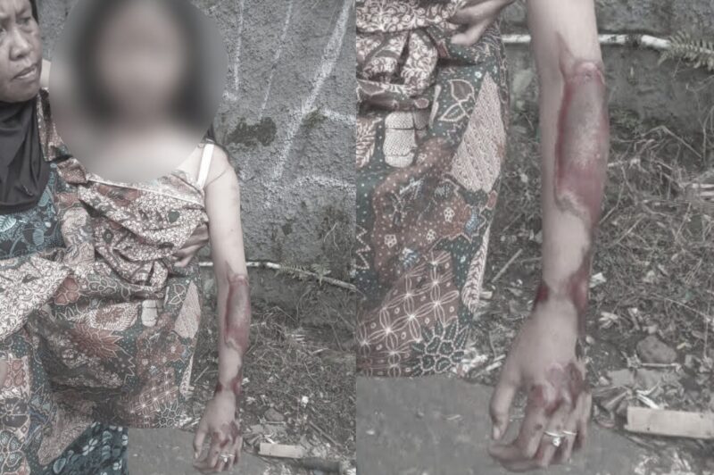 AH, bocah perempuan jadi korban jambret HP di Sukabumi terseret hingga 200 meter - Ist