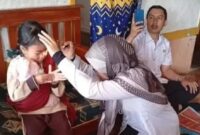 Nasib pilu Syakira, bocah di Sukabumi alami kelainan mata tak berkedip sejak lahir - Ist