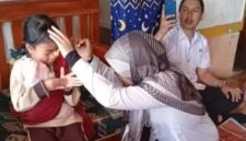 Nasib pilu Syakira, bocah di Sukabumi alami kelainan mata tak berkedip sejak lahir - Ist