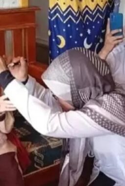 Nasib pilu Syakira, bocah di Sukabumi alami kelainan mata tak berkedip sejak lahir