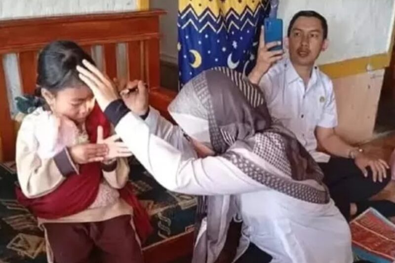 Nasib pilu Syakira, bocah di Sukabumi alami kelainan mata tak berkedip sejak lahir - Ist