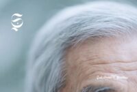 Rambut beruban - sukabumiheadline.com