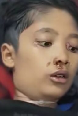 Anak 12 tahun di Sukabumi dianiaya ibu tiri hingga tewas