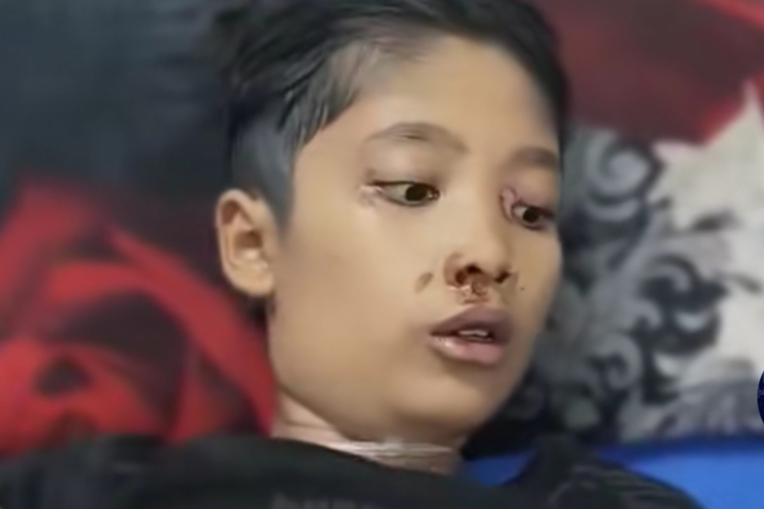 NS, anak 12 tahun di Sukabumi dianiaya ibu tiri hingga tewas