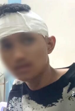 Pengakuan siswa SMK Pertanian Sukabumi asal Parungkuda korban pembacokan pelajar