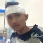 RM, pelajar SMK Pertanian Cibadak korban pembacokan pelajar lainnya - sukabumiheadline.com