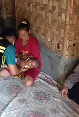 Rania, bayi stunting di Cikidang Sukabumi akhirnya ditangani polisi